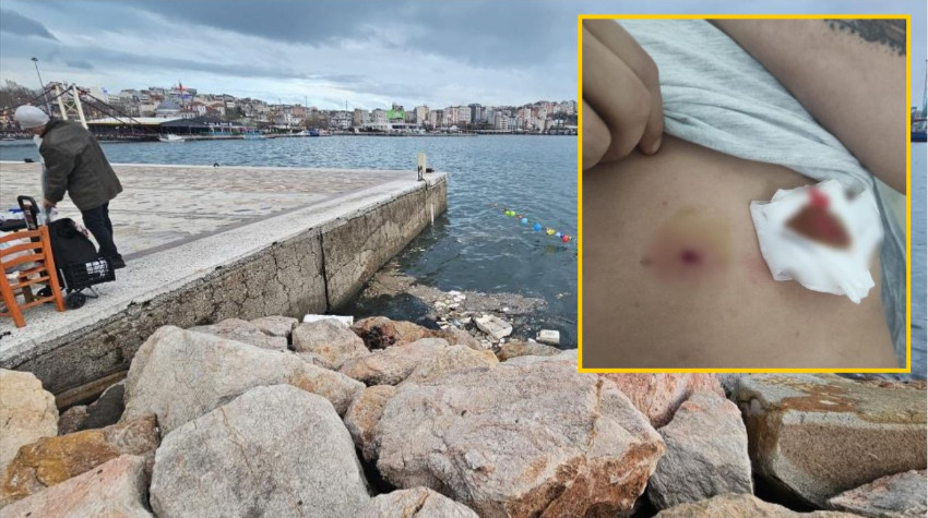 Balıkesir Bandırma’da Havalı Tüfek Kazası: 1 Kişi Hastanede